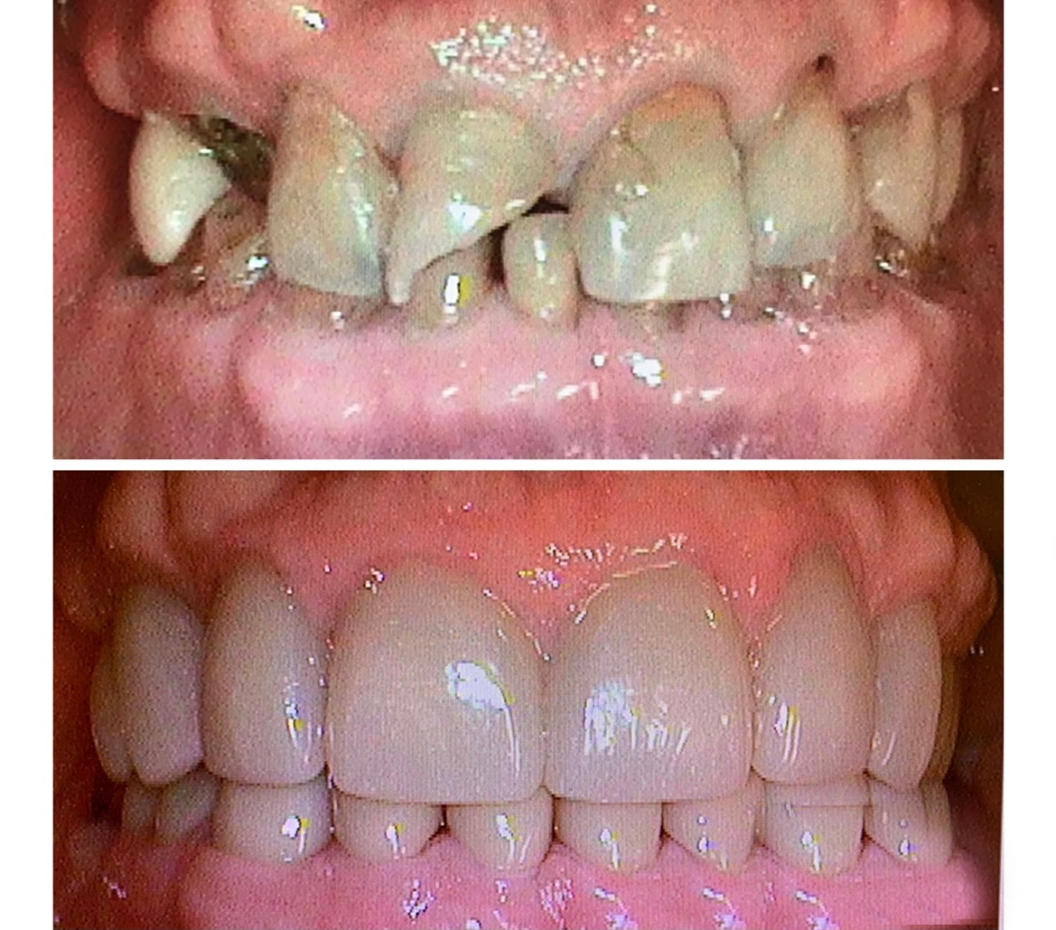 Gardens Dental Spa Gardens Dental Spa