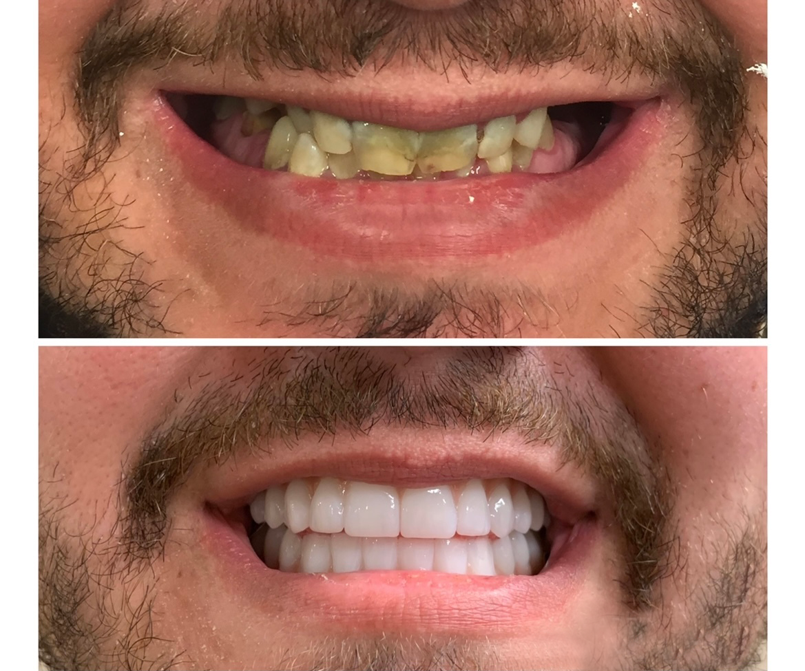 Gardens Dental Spa Gardens Dental Spa