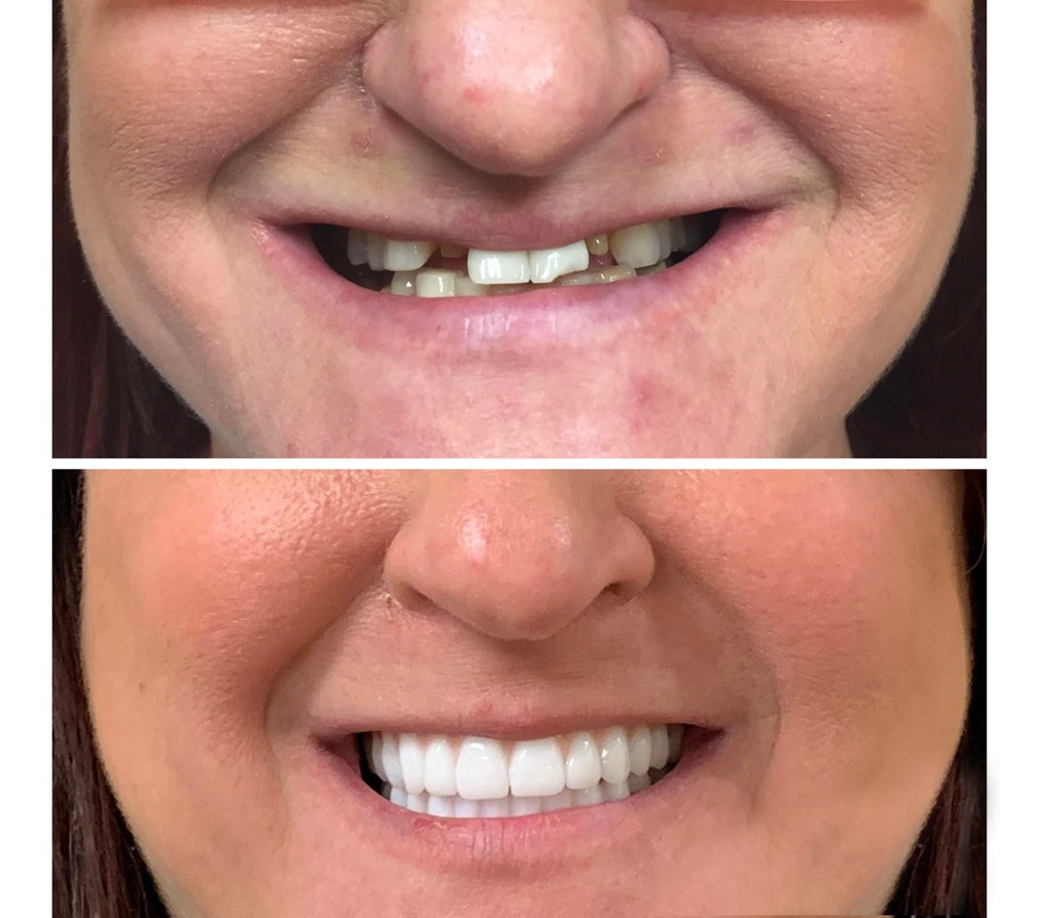 Gardens Dental Spa Gardens Dental Spa