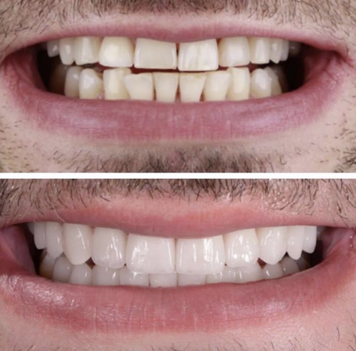 Gardens Dental Spa Gardens Dental Spa