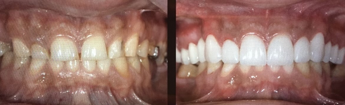 Gardens Dental Spa Gardens Dental Spa