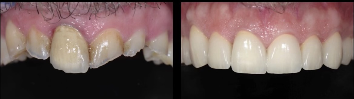 Gardens Dental Spa Gardens Dental Spa