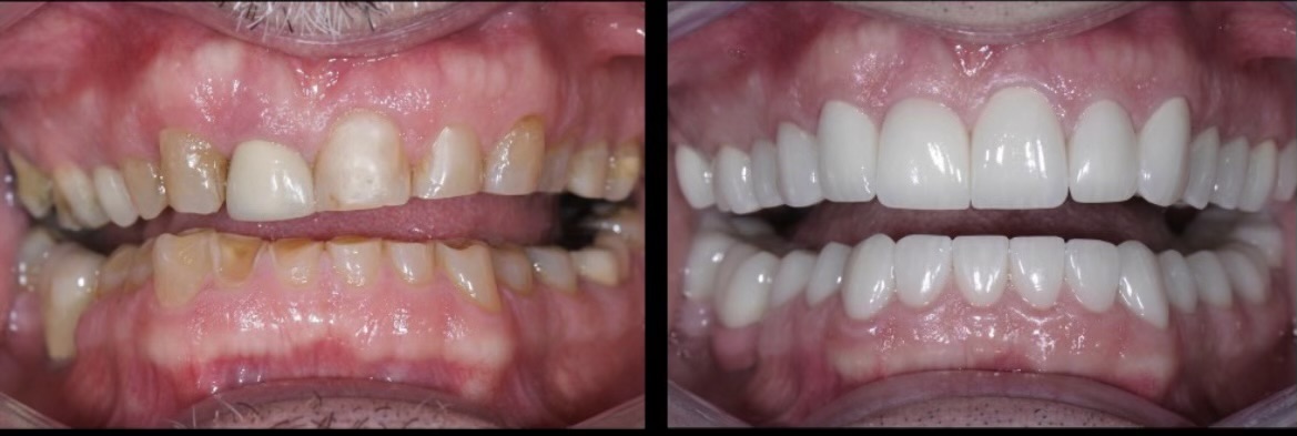 Gardens Dental Spa Gardens Dental Spa