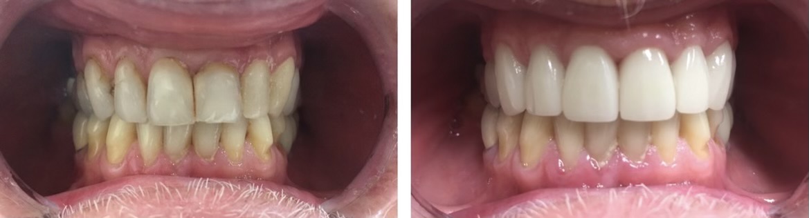 Gardens Dental Spa Gardens Dental Spa