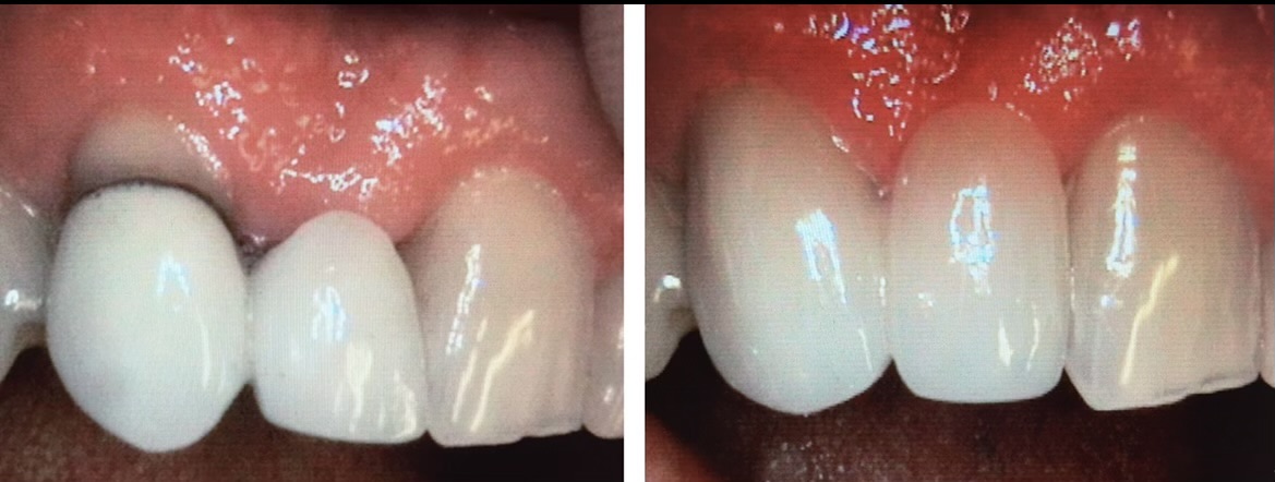 Gardens Dental Spa Gardens Dental Spa