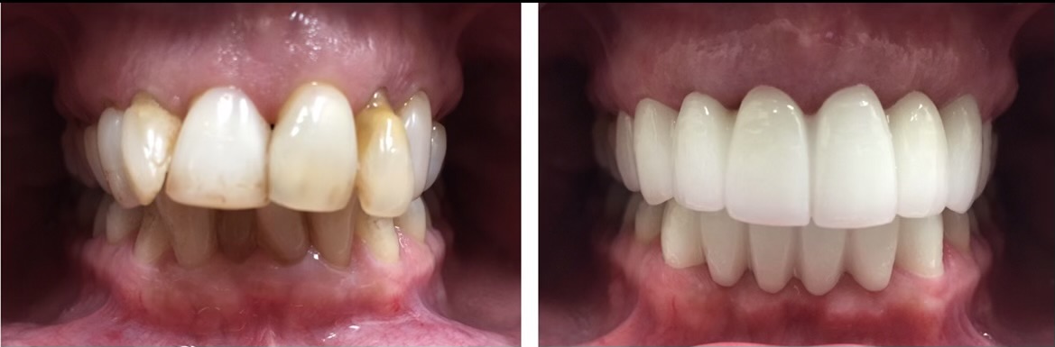 Gardens Dental Spa Gardens Dental Spa
