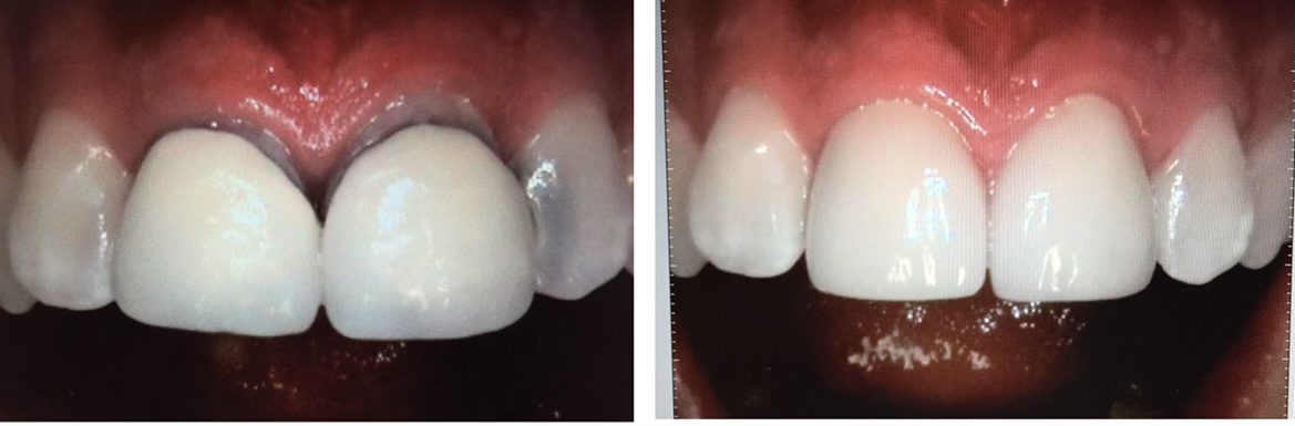 Gardens Dental Spa Gardens Dental Spa