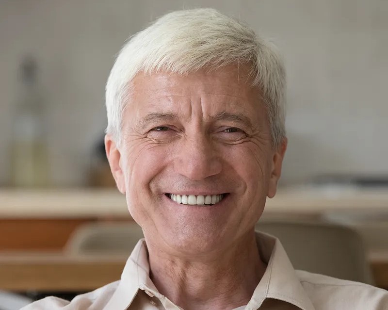 All-On-4 Implants All-On-4 Implants