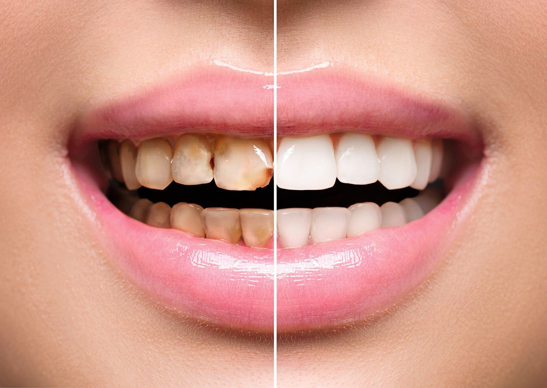 Gardens Dental Spa Gardens Dental Spa